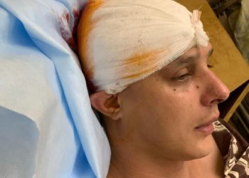 У Києві жорстоко побили автора пісень гурту KAZKA