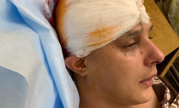 У Києві жорстоко побили автора пісень гурту KAZKA