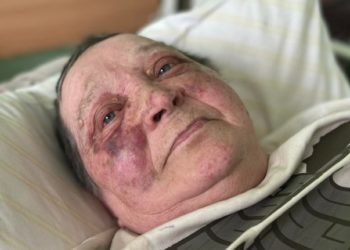 70-річна журналістка з Херсона, якій рашисти зламали хребет, змогла втекти від окупантів і не відмовилася від українського паспорта
