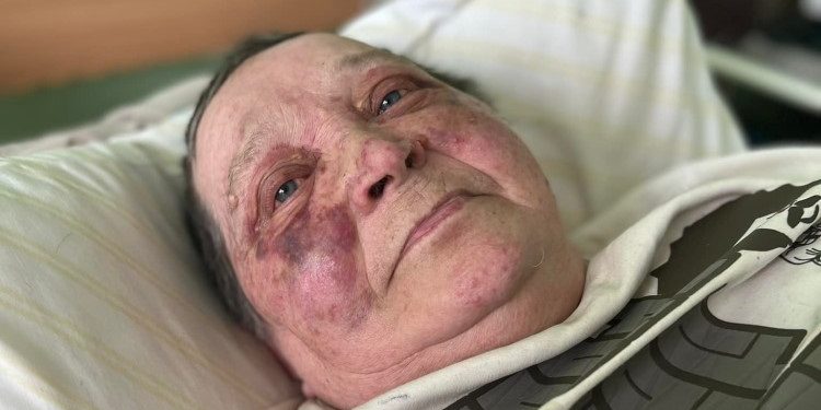 70-річна журналістка з Херсона, якій рашисти зламали хребет, змогла втекти від окупантів і не відмовилася від українського паспорта