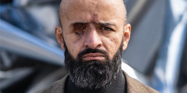 Адвокат Масі Найєм, який втратив око на війні, став обличчям українського бренду одягу (фото)