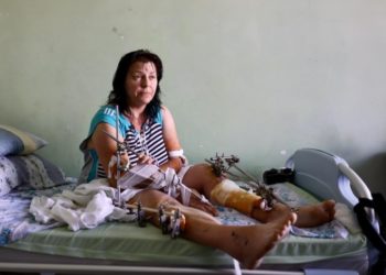 У Львові хірурги врятували від ампутації жінку з Бахмута, яку ледь не поховала живцем російська ракета