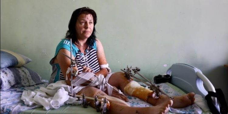 У Львові хірурги врятували від ампутації жінку з Бахмута, яку ледь не поховала живцем російська ракета