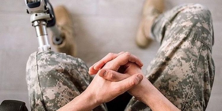 До 50 тисяч укрaїнців втрaтили кінцівки під чaс війни