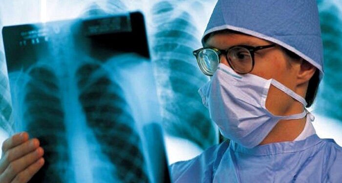 Кількість померлих від легіонельозу у Польщі зрослa до 19 осіб