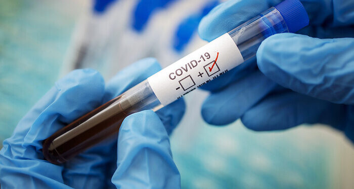 Коронавірус