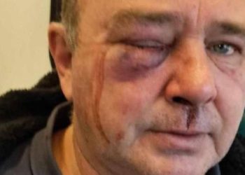 Побили чоловіка на Київщині