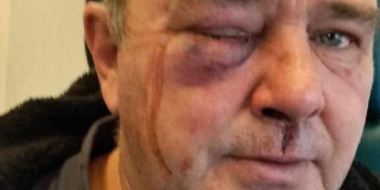 Побили чоловіка на Київщині