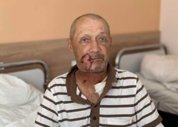 Фото постраждалого після операції