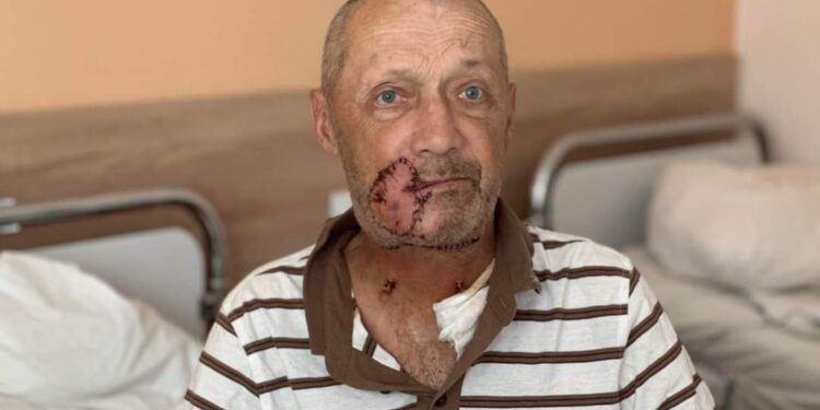 Фото постраждалого після операції