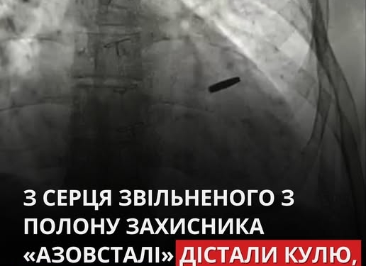 Військовий перебував у полоні з кулею в серці