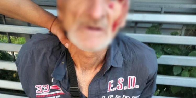 У Києві чоловік нападав на жінок