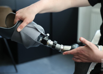 Реабілітація нового рівня: Нацгвардія та «Форвард-Орто» об’єднують зусилля у Тернополі