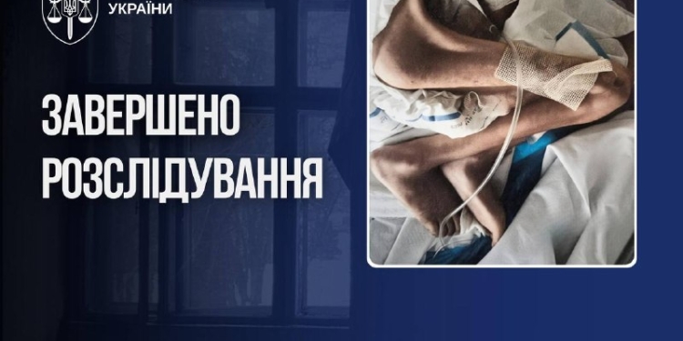 На Буковині судять матір, чий син помер від виснаження